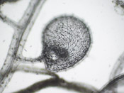 Utricularia praetermissa - Fangblase